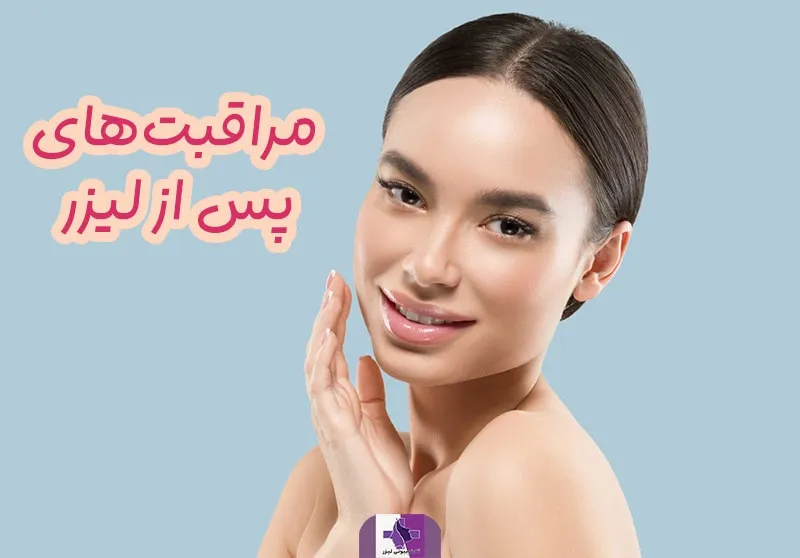 مراقبت بعد از لیزر