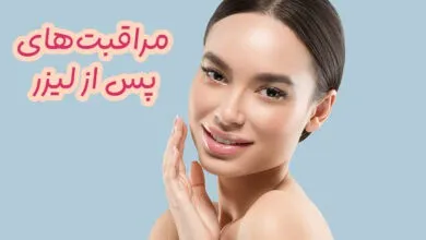 مراقبت بعد از لیزر