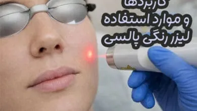 لیزر رنگی پالسی