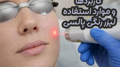 لیزر رنگی پالسی