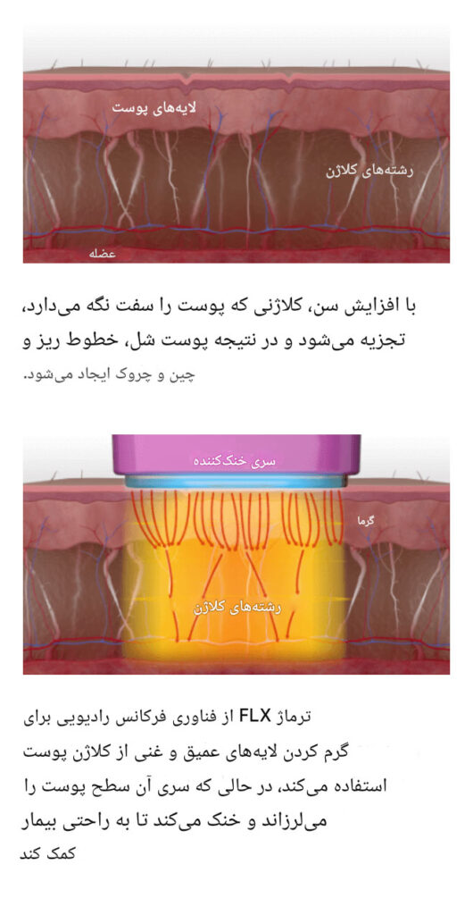 ترماژ