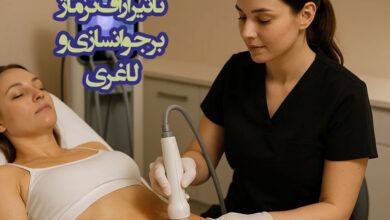 ترماژ تراپی