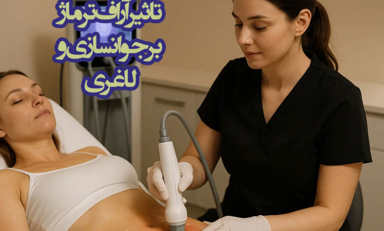 ترماژ تراپی