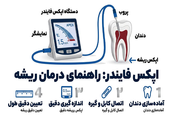 اپکس دستگاه لیزر اپکس فایندر