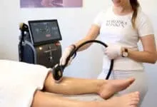 دستگاه لیزر مو هانس