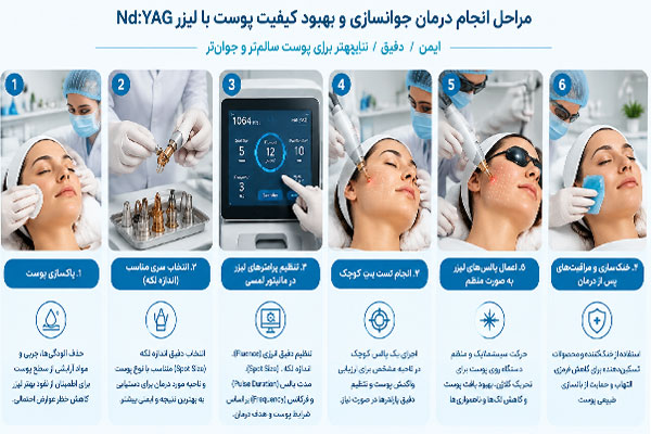 دستگاه-لیزر-ان-دی-یاگ نحوه کار با دستگاه لیزر ان دی یاگ