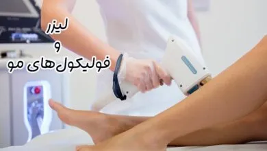تاثیر لیزر بر فولیکول