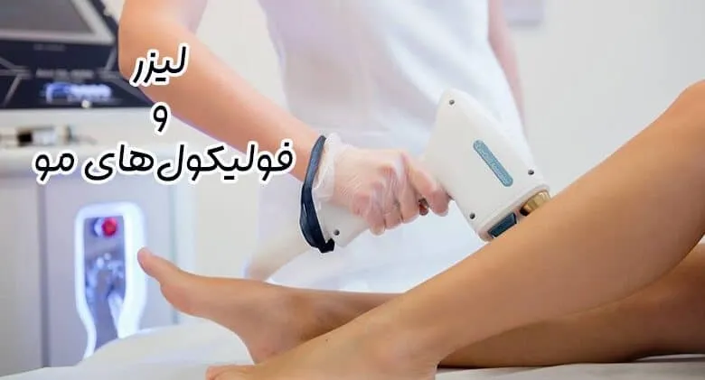 تاثیر لیزر بر فولیکول