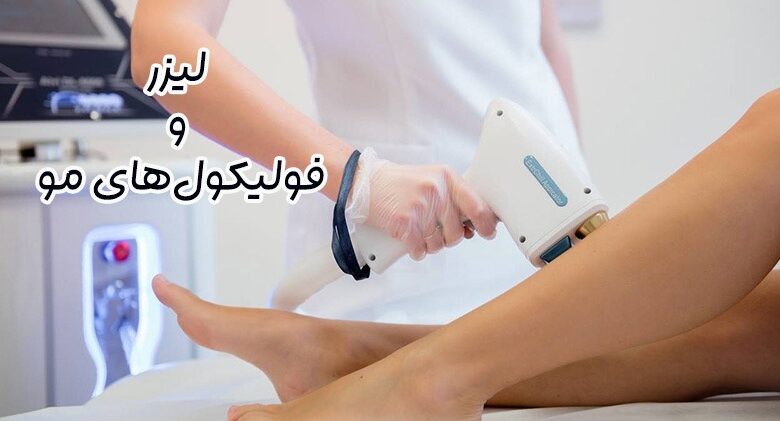 تاثیر لیزر بر فولیکول