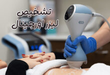 دستگاه‌ لیزر اورجینال