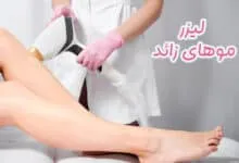 لیزر موهای زائد