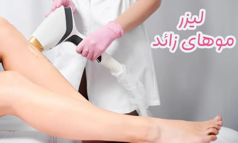 لیزر موهای زائد