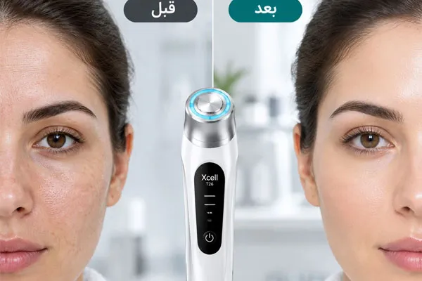 لیزر-خانگی-ایکسول-T26 لیزر خانگی ایکسول T26